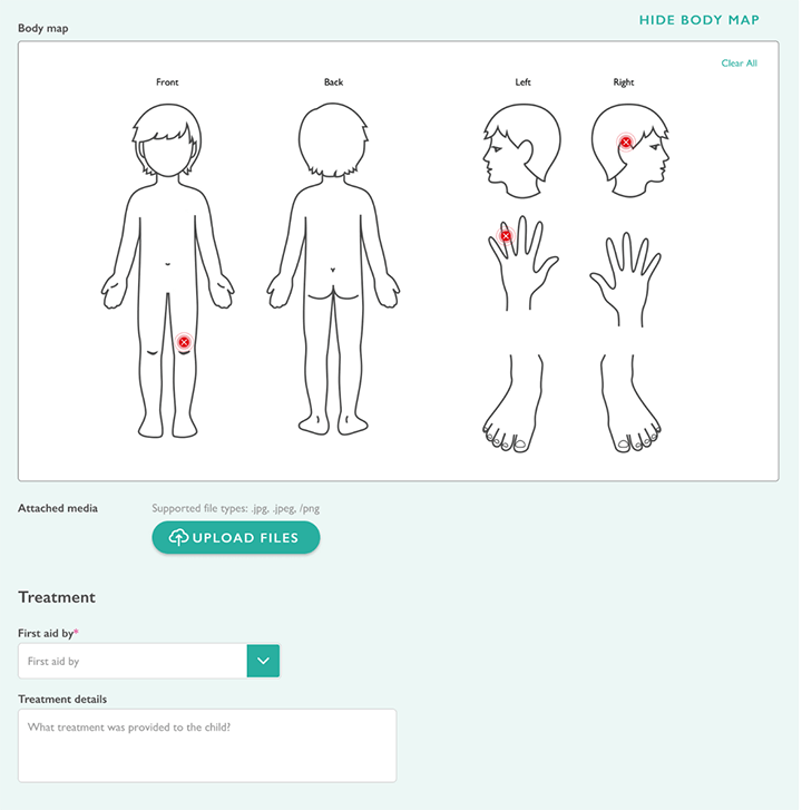 Updated Accident and Incident forms product update - Body maps