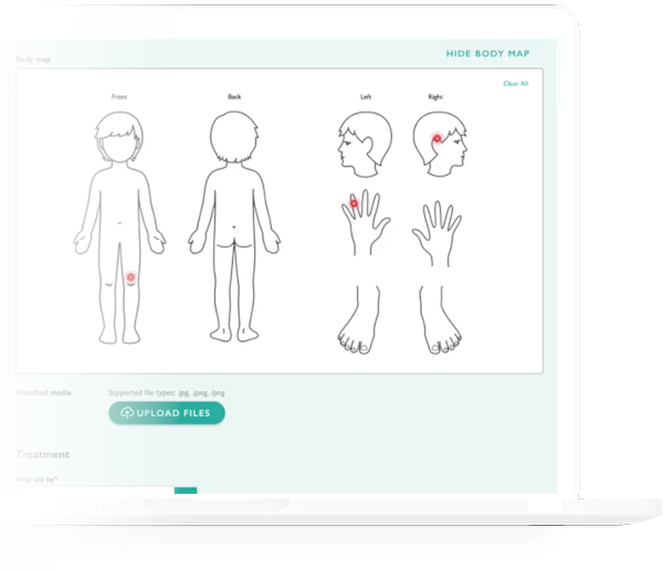 A computer screen showing the new accidents body map